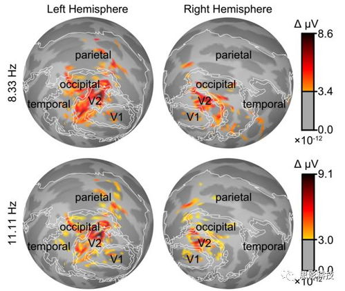 腦磁圖（MEG）數(shù)據(jù)處理 思影數(shù)據(jù)處理服務六的專業(yè)解決方案